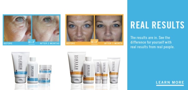 real results rodan and fields